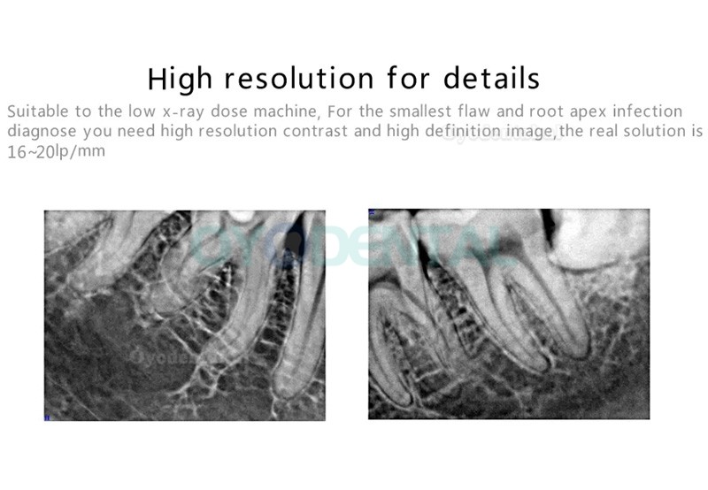 Handy HDR-600A Digitale tandheelkundige röntgensensor intraorale sensor beeldvormend systeem 